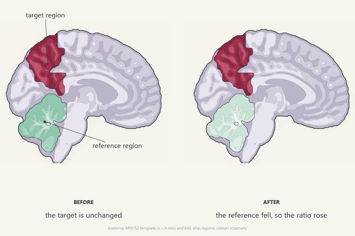 The same real brain slice twice: the target region is unchanged while the cerebellar reference region is paler after, so the ratio rises